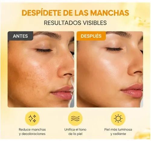 Zww Crema Aclaradora De Manchas Oscuras Con Cúrcuma Y Ácidoz