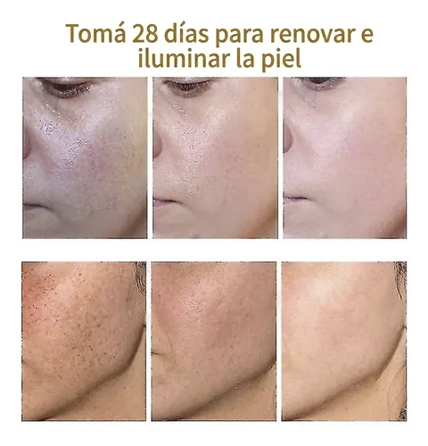 Crema Anti Manchas Oscuras 20ml Hiperpigmentación Facial
