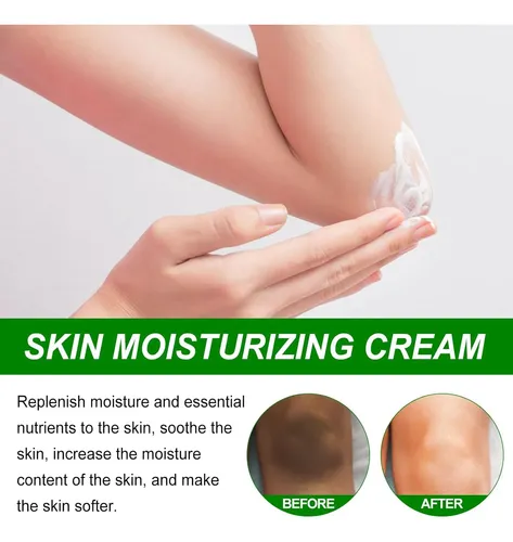 2026 New Crema Para Manchas Oscuras En La Cara, Day & Night