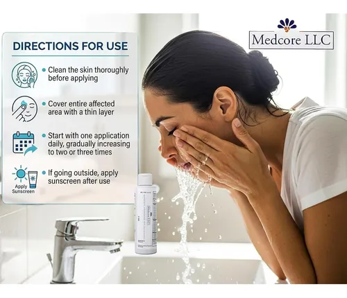 Medcore Benzoyl Peroxide 10% Limpiador Facial 5 Oz