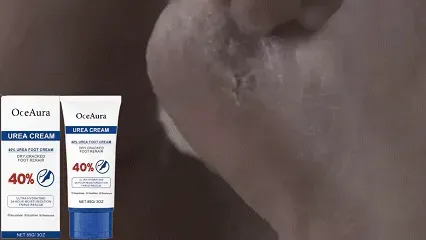 Mcrema Pies Urea Oceaura Talones Suaves Exfolia Únicax