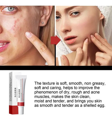 Crema Desvanecedora De Manchas Y Pecas Facial 20g