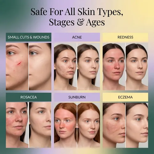 Hypochlorous Acid Spray For Face And Skin | Hoci Facial