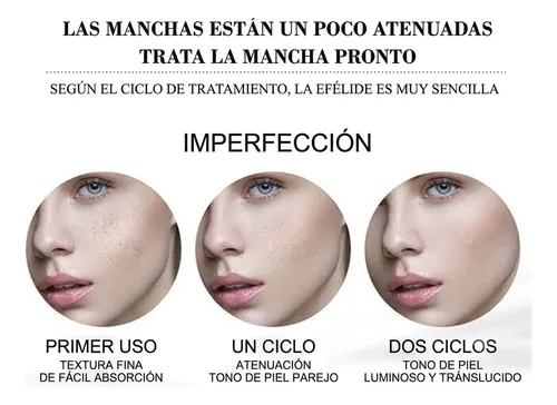 Crema Anti Manchas Oscuras 20ml Hiperpigmentación Facial