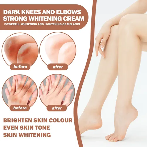 Cuidado Dark Spot Cuidado Crema Locion Corporal 50g