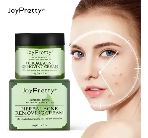 Crema Facial Eliminadora De Acné A Base De Hierbas Joypretty
