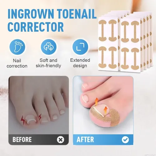 Nuevo Set De Manicura Y Corrector De Uñas Encarnadas