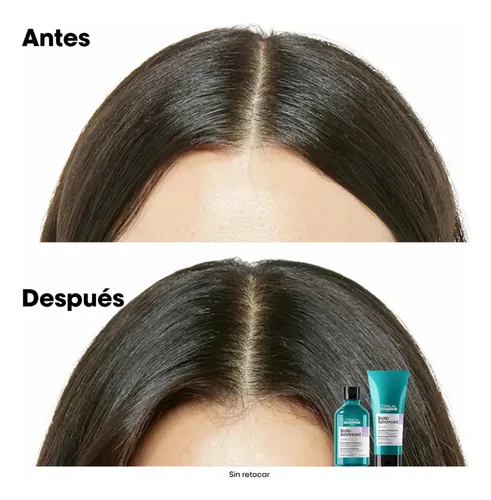 Shampoo Limpieza Profunda Cabello Graso Scalp Loreal 300ml