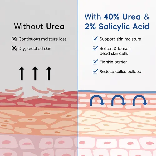 Crema De Urea 40% Quiyum 100g – Repara Talones Y Callos