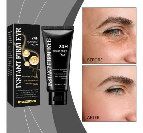 Crema De Ojos Antiedad Y Antiarrugas 60 G Todo Tipo De Piel Día/noche