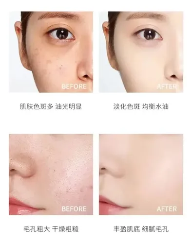 Hih Milk Cover Water Esencia Facial Niacinam Vitamina C Glow Mixta Día/noche