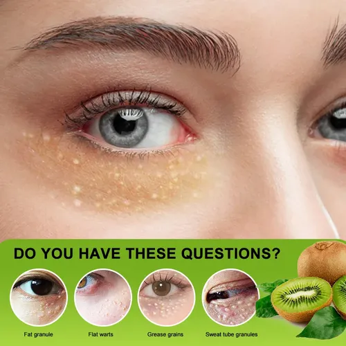 Pomada Contorno Ojos Vitamina Para Milium X2