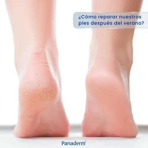 Panaderm Humectación Intensa Urea 10% Loción Corporal 500 Ml