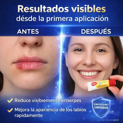 Carmex Bálsamo Labial Herpes Alivio Original Usa 15spf