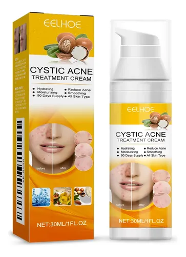 Sérum Facial Eelhoe Para Una Piel Clara Y Minimizar Los Poro