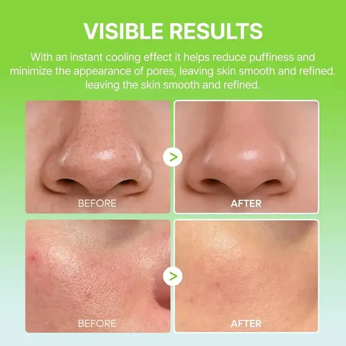 Bálsamo En Barra Dr.melaxin Cactox Pore Relief