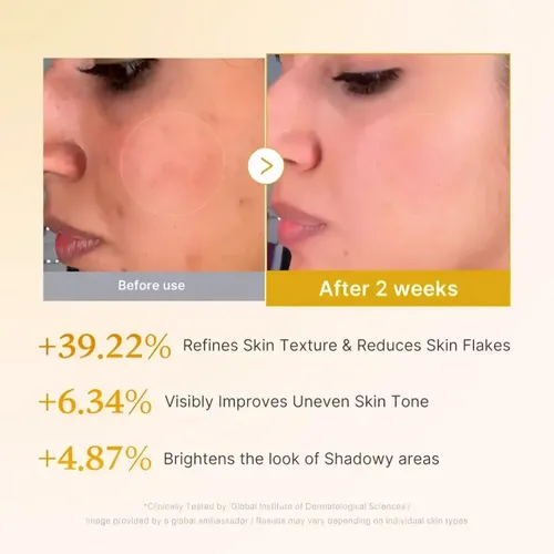 Tónico Facial Coreano Medicube Ácido Kójico Y Cúrcuma 250ml