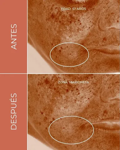 Kit Sérums Kosmos Skincare – Vitamina C Y Retinol Antiage