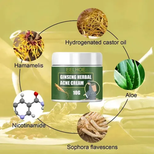 Crema Para El Acné Con Ginseng, 50 G – Oil Control,;