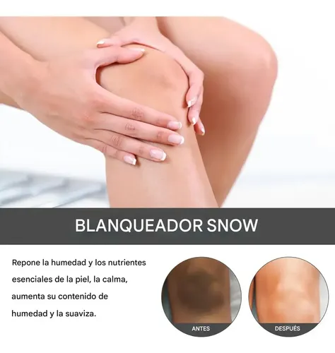Crema Blanqueadora, Crema Iluminadora, Para Axilas, Rodillas, Codos, Muslos Internos, Línea Del Bikini, Crema.