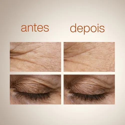 Sérum De Ojos Superreductor De Arrugas Natura Chronos,