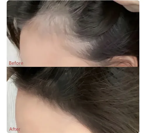 Maquillaje Capilar En Polvo Gege Bear Corrige Fallas Cabello Barba Corrigiendo Líneas Irregulares