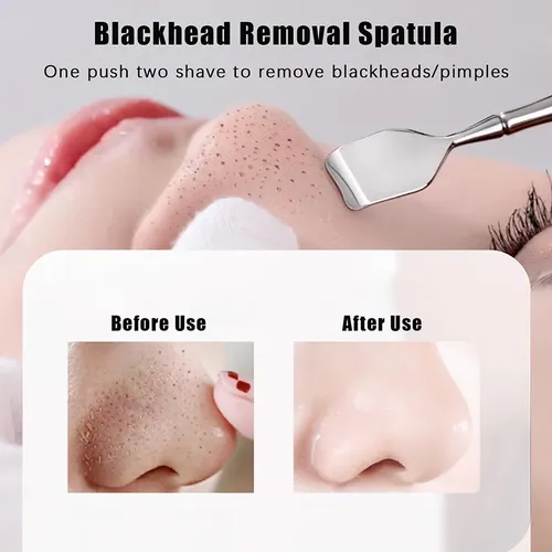 Acero Inoxidable  Herramienta De Doble Cabezal Blackhead