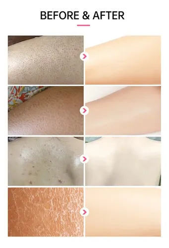 Crema Reparadora Urea 25% Para Piel Seca Y Áspera Joypretty Fragancia Neutra