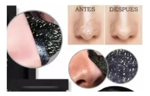 Mascarilla Elimina Puntos Negros X12u Todo Tipo De Piel