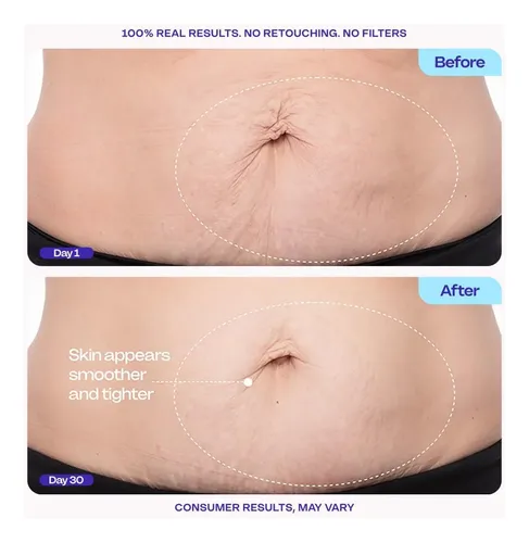 Crema Reafirmante Para El Vientre Gopure, Reafirmante Para E