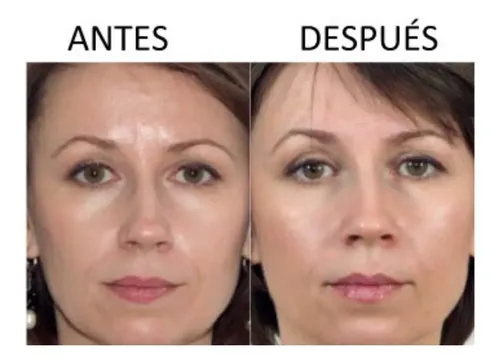 Reparador Intensivo De Ojeras Idraet Sublime Eyes Peptides