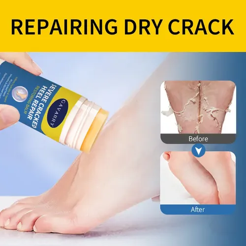 Crema Hidratante Reparadora De Grietas En Los Pies