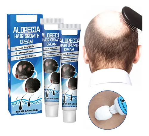 Tratamiento Alopecia Areata Anticaída Cabello Natural