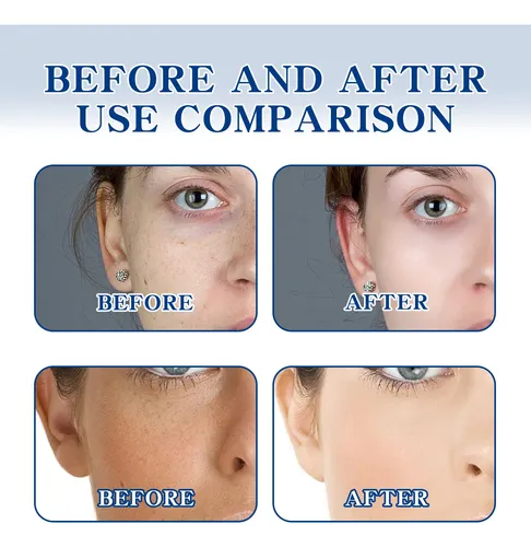 Crema Facial Iluminadora Ouhoe Para Un Tono E Hidratación Un