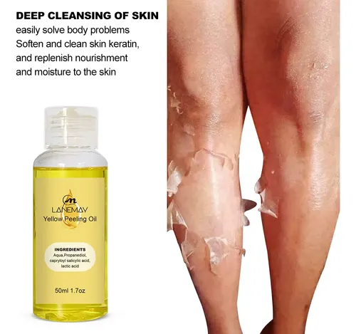 Aceite Exfoliante, Aceite De Peeling Amarillo