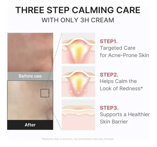Skin Medicube 3h Relief Cream Reparadora De Acne Rosacea Todo Tipo De Piel Día/noche
