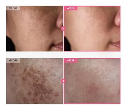 Crema Facial Arbutina 7% Y Ácido Tranexámico 50ml