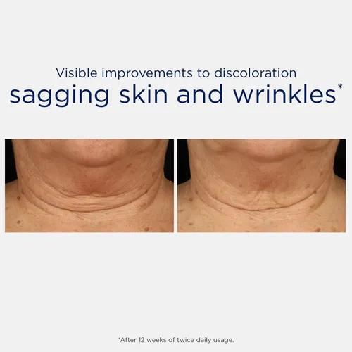 , Crema De Cuello Triple Reafirmante Neostrata, Nova E Nova F