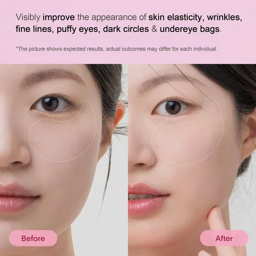 Parches De Hidrogel Para Ojeras Debajo De Los Ojos, 60 Unida
