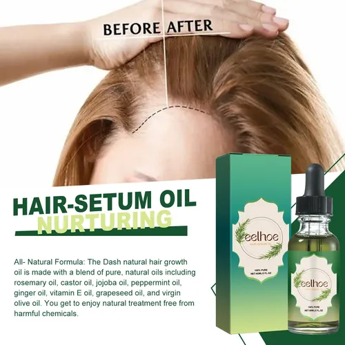 Aceite Capilar De Romero Eelhoe Para Cabello Fuerte Y Grueso