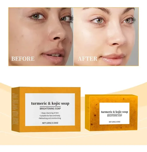 Jabón De Limón Y Cúrcuma Kójico Iluminador Facial Y H