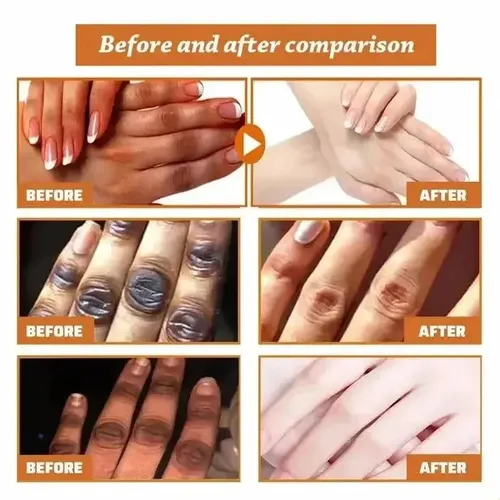 Sérum Iluminador Dark Knuckles Para Codos, Rodillas Y Piel O