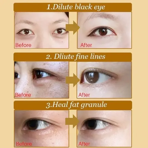 C.60 Pares Parches Ojos Colágeno Hidrogel Elimina Ojerasc.