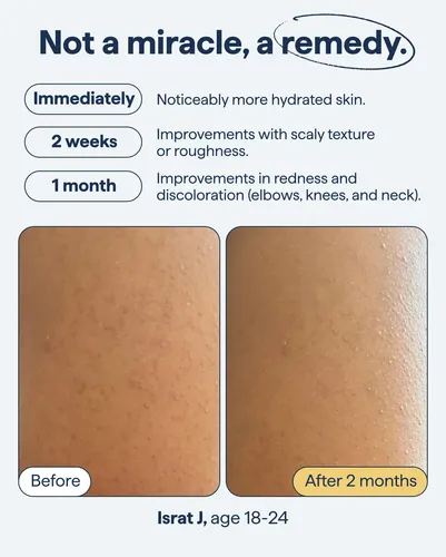 Exfoliante Corporal E Hidratante Remedy Science 200 Ml+225 M
