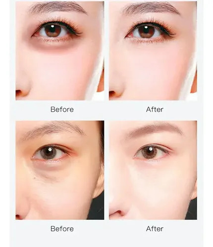 2x Parches Hydrogel For Ojos Colágeno Anti Ojera Hidratante