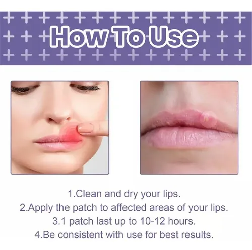4parches Suavizantes For Herpes Labial Parche Curativo .