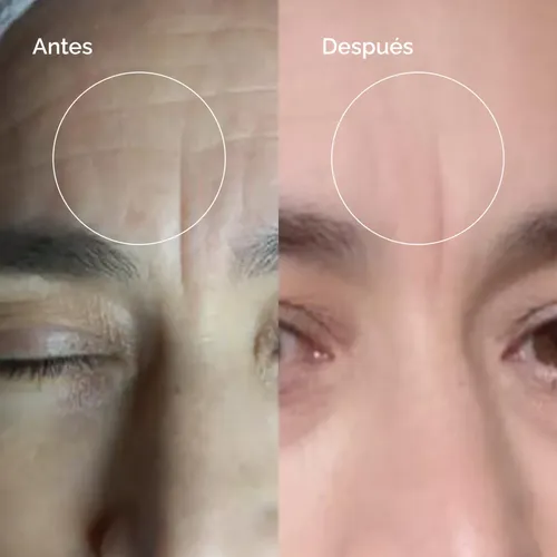 Serum Retinol 0,1% Cloe 30ml Antiarrugas Y Antimanchas