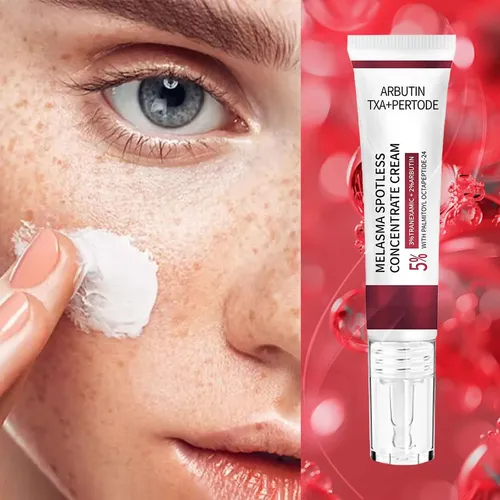 Crema Iluminadora Concentrada Melasma Spotless Cream De Z Mi
