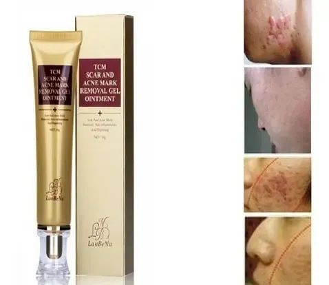 Gel Cicatrices Manchas Estrias Acne Crema No Cicatricure