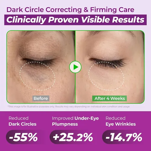 Jumiso Niacinamide 5+ Dark Circle Correcting Contorno De Ojo